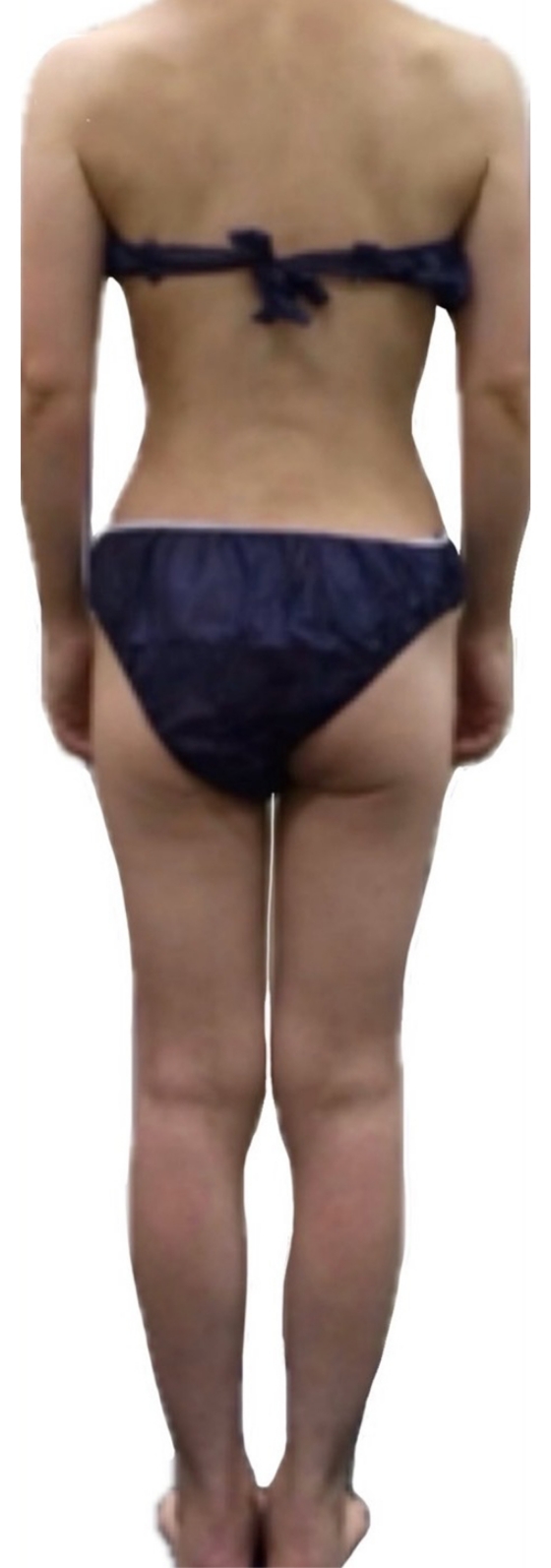 即効スリムコース