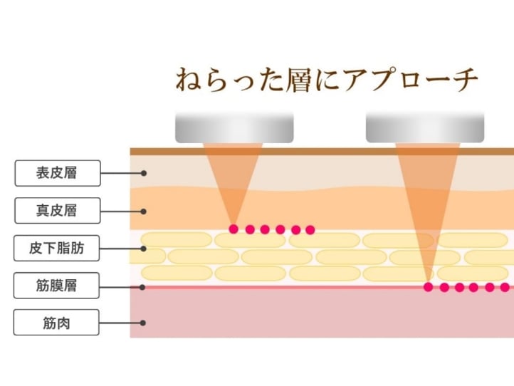 肌の深い層「筋膜層」へのアプローチ